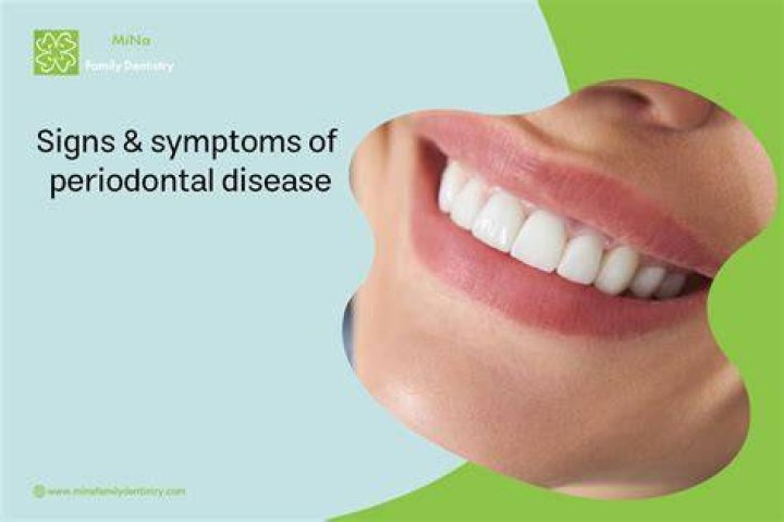 10 Signs & Symptoms of an Unusual Blood Clot You Should Know Top 10
