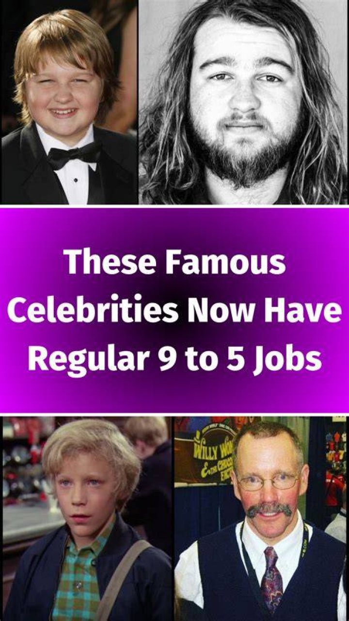 9 Celebrities Who Have Most Plastic Surgery Operations Cosmeticium