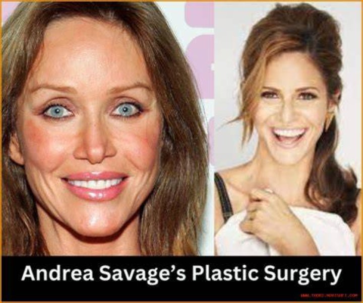 A Deep Dive Into His Plastic Surgery Journey