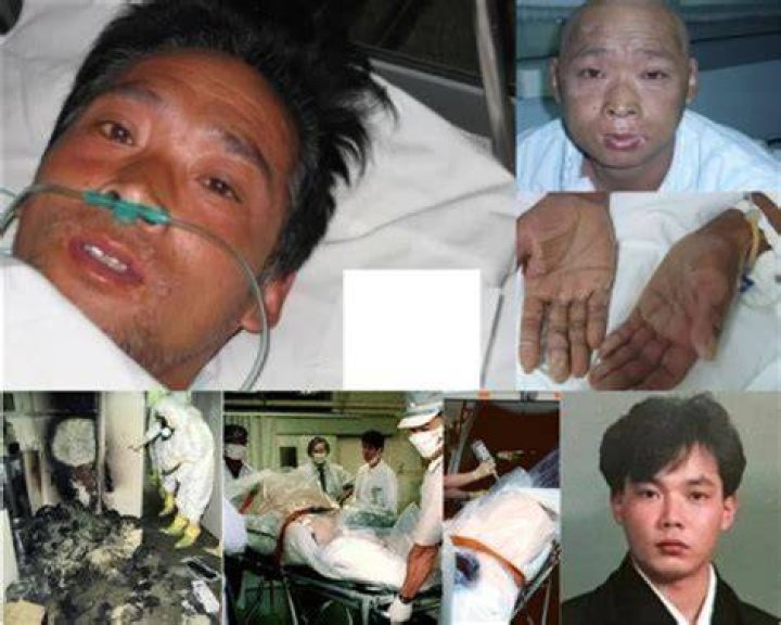 A Look At The Tragic Aftermath: Hisashi Ouchi's Body Photos