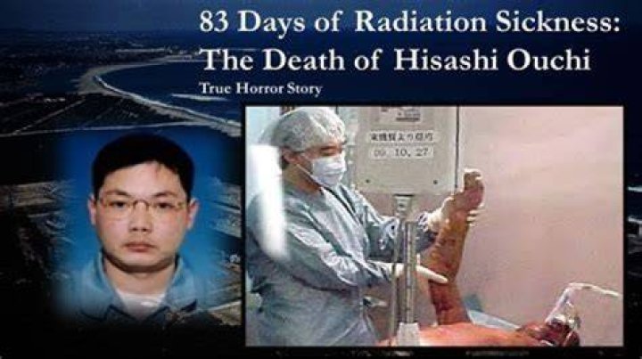 A Tragic Tale Of Radiation Exposure