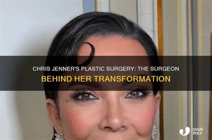 Chris Evert’s Plastic Surgery Her New Look Examined!