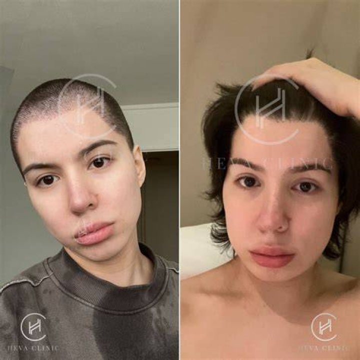 De 234 b&auml;sta mtf before & afterbilderna p&aring; Pinterest