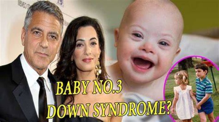 George Clooney's Son: The Truth About Down Syndrome