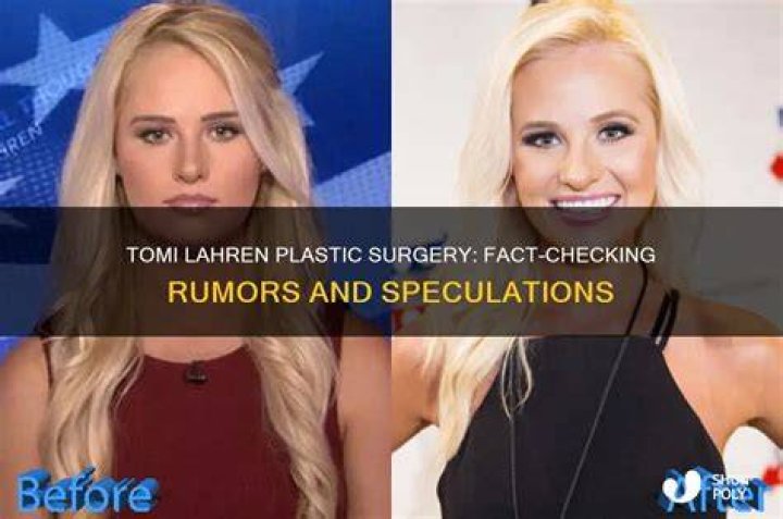 Has Tomi Lahren Had Plastic Surgery? Before And After Photos On IG