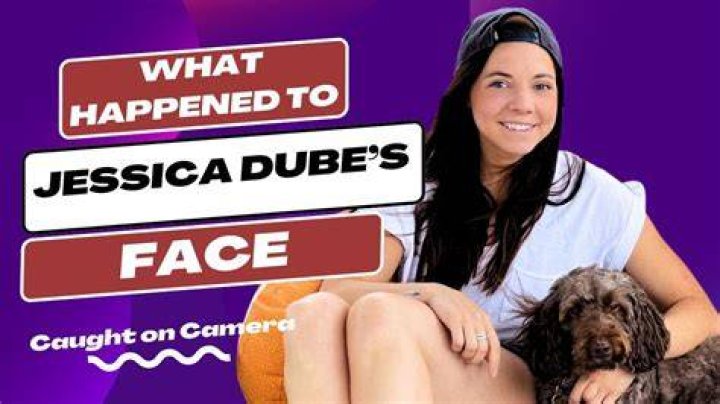 Jessica Dube&rsquo;s Scar How Is It Now? Face Injury & 2023 Update!