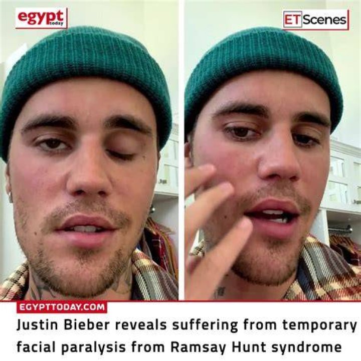 Justin Bieber Reveals He’s Battling Lyme Disease