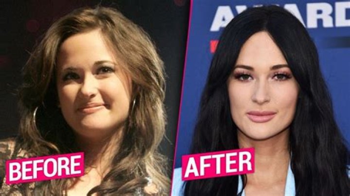 Kacey Musgraves Plastic Surgery Lips, Nose Job, Body Measurements