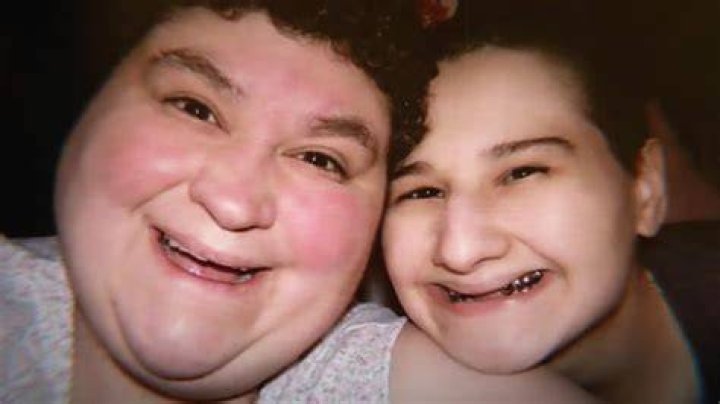 Kassenbon Eigentlich vorteilhaft gypsy rose blanchard teeth binden