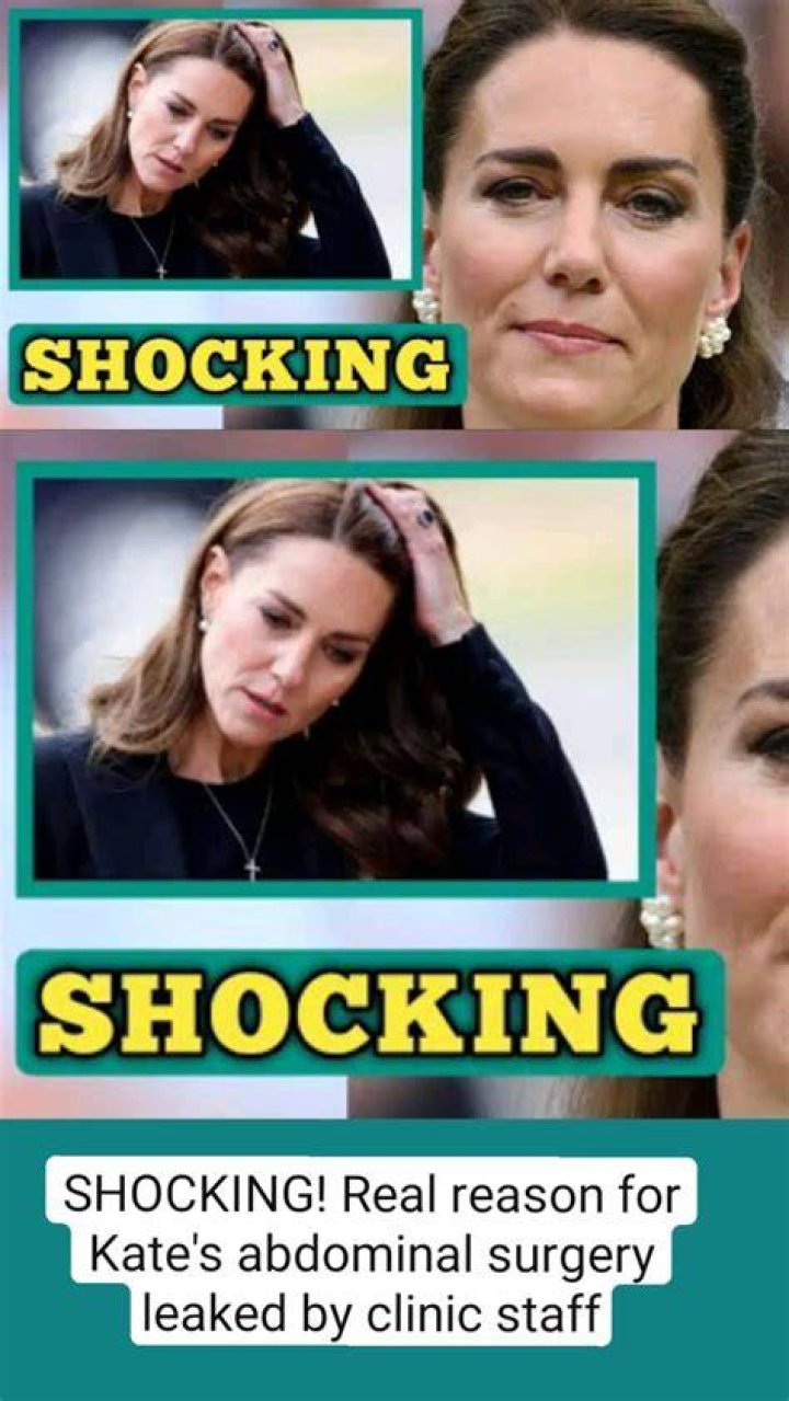 Kate's Abdominal Surgery: Uncovering The Type