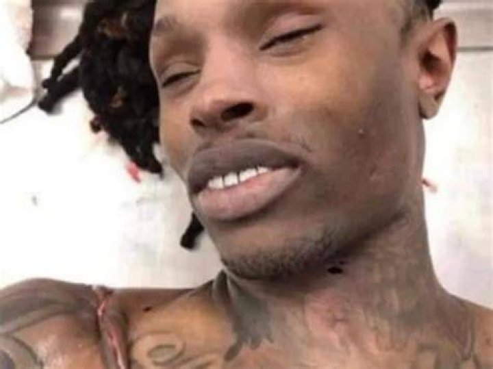 King Von's Autopsy Images Revealed