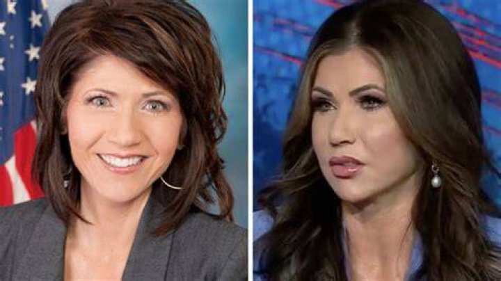 Kristi Noem Before Plastic Surgery / Kristi Noem Photos Of The South