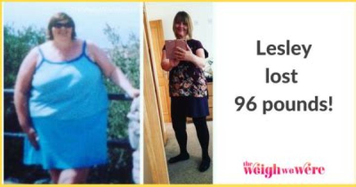 Lesley Sharp&rsquo;s Weight Loss Did She Receive Surgery? How Did She Lose