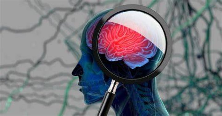 New imaging technique to identify and treat the blood clots