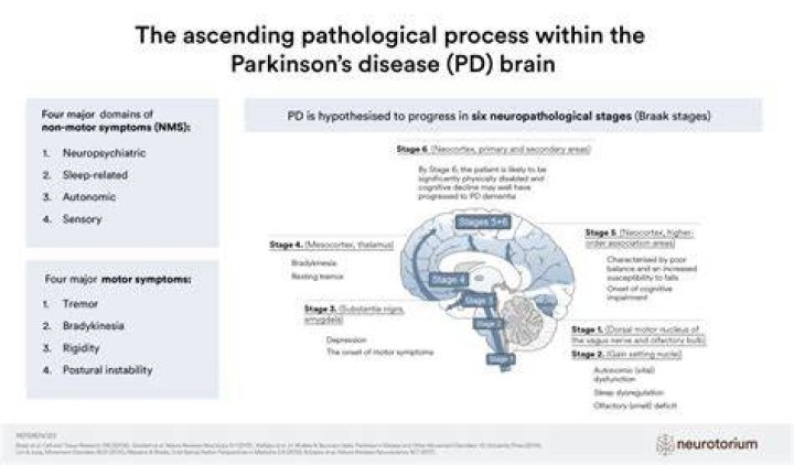 Parkinson disease (PD) What Is It ? How Its Caused