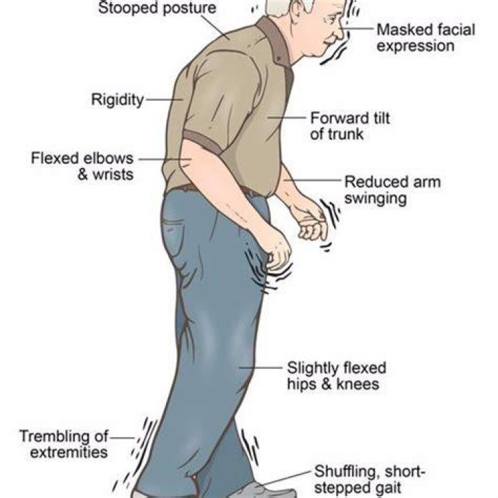 Parkinson's Disease Legacy Spine & Neurological Specialists
