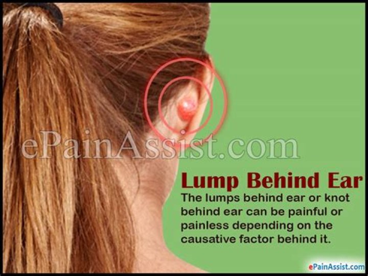 Swollen Lump Behind Ear My XXX Hot Girl