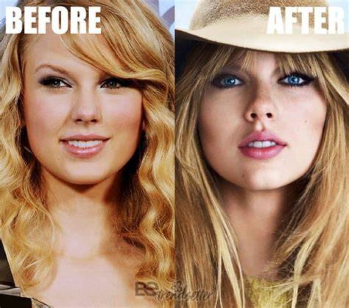 Tajemnica chirurgii plastycznej Taylor Swift rozwiązana! Hippocrates