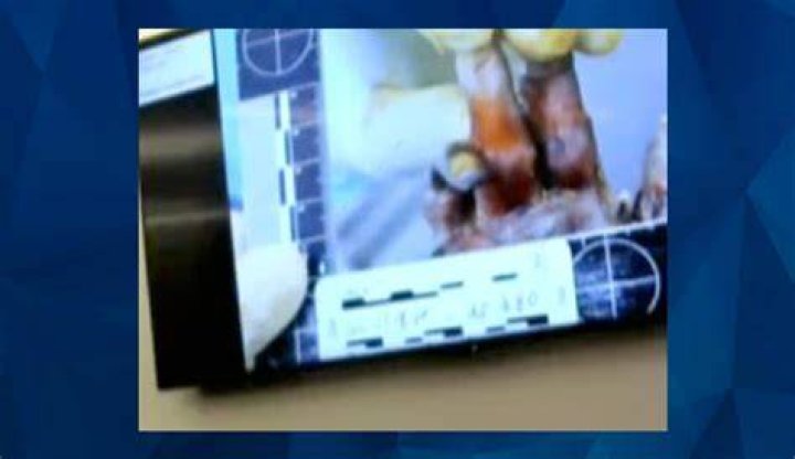 The Chilling Truth: Gannon Stauch Autopsy Photos Leak Aftermath