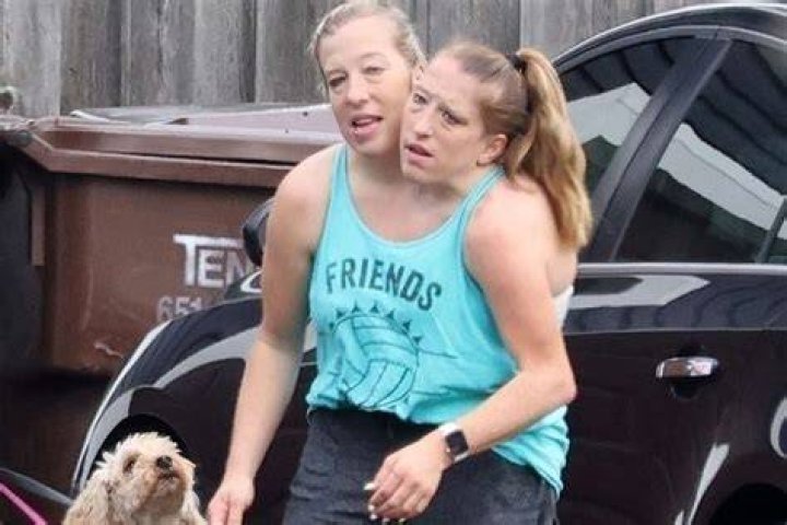 The Heartbreaking Story Of Abby And Brittany Hensel's Family Tragedy