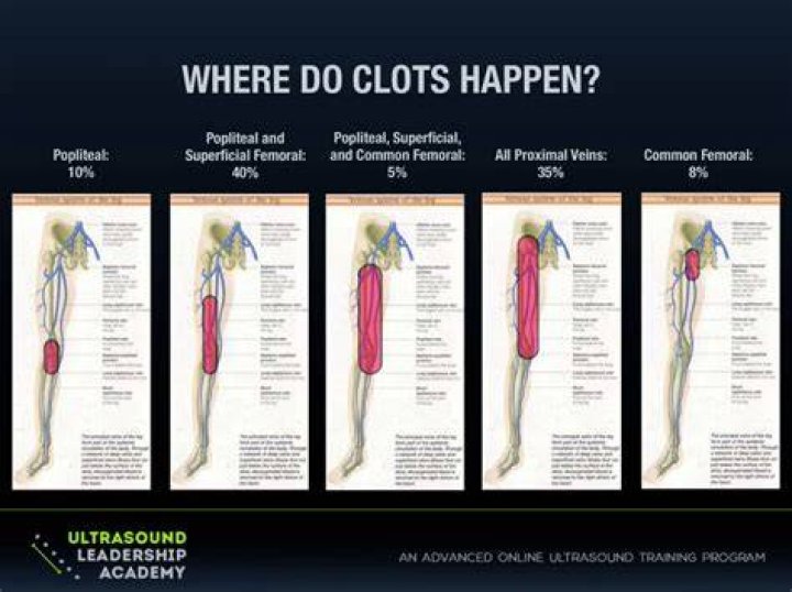 Ultrasound Leadership Academy Lower Extremity DVT &mdash; EM Curious