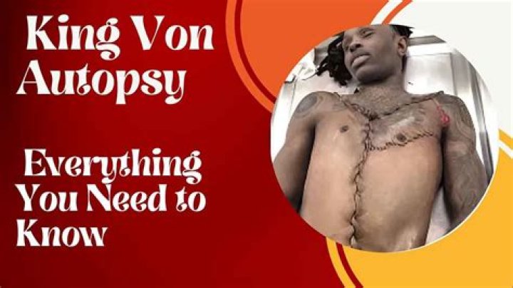 Was King Von Autopsy Leaked? How Did The Rapper Die?