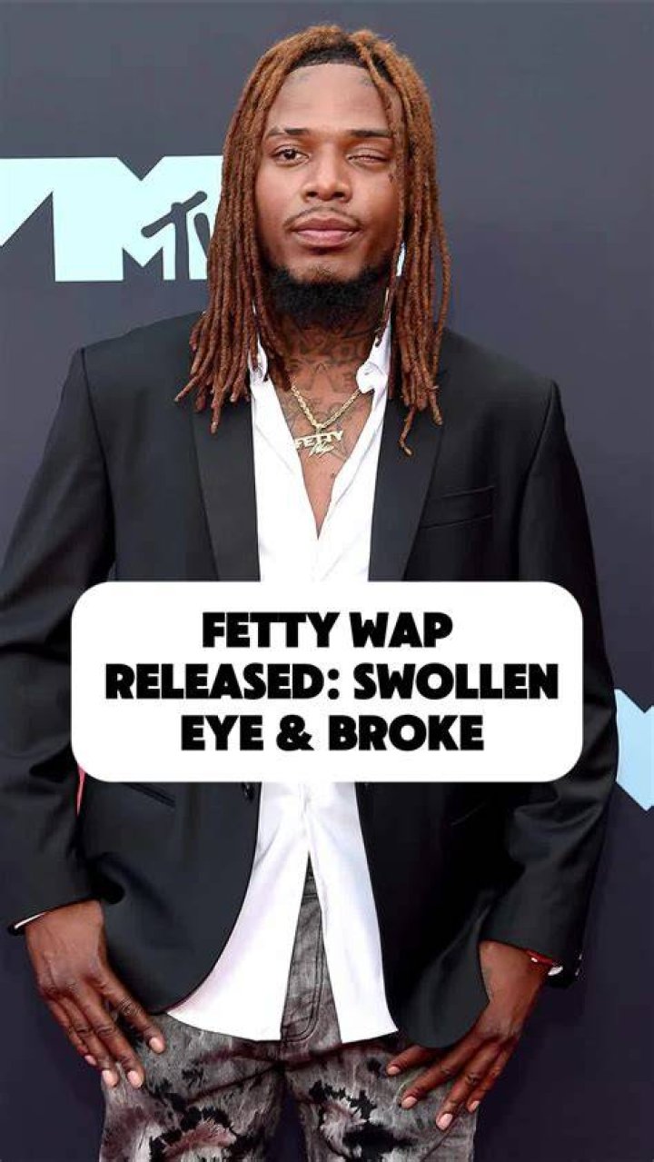 What Happened to Fetty Wap’s Eye? HERE'S THE REAL STORY