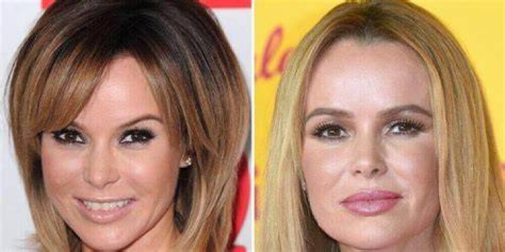 What Plastic Surgery Has Amanda Balionis Had Done?