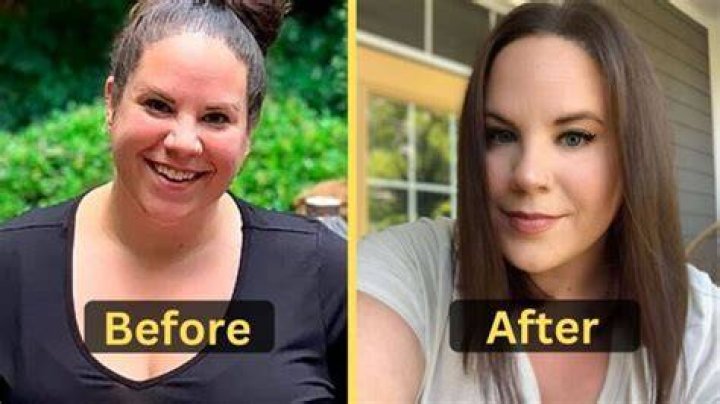 Whitney Thore Weight Loss Surgery, Diet & Workout Weight Loss