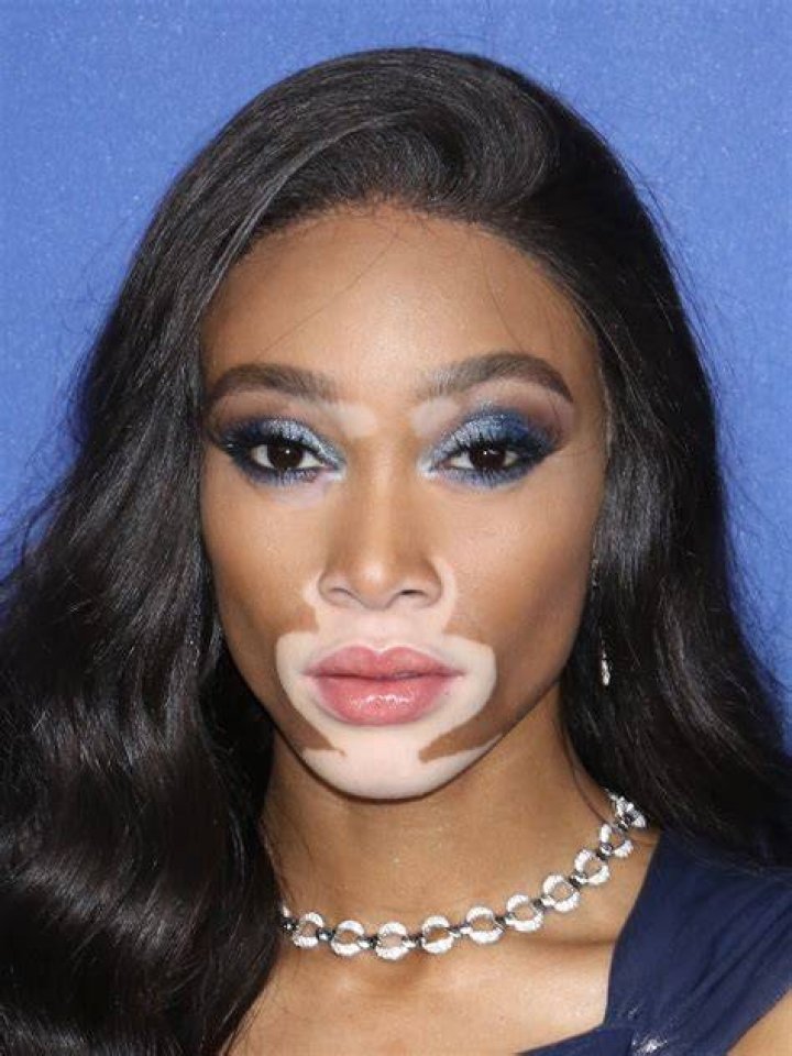 Winnie Harlow’s Stank Attitude Almost Got Her Dragged at Party; Trey
